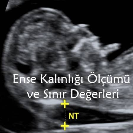 Ense kalınlığı ölçümü