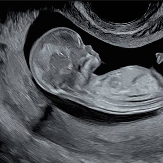 İki boyutlu ultrason, ayrıntılı ultrason