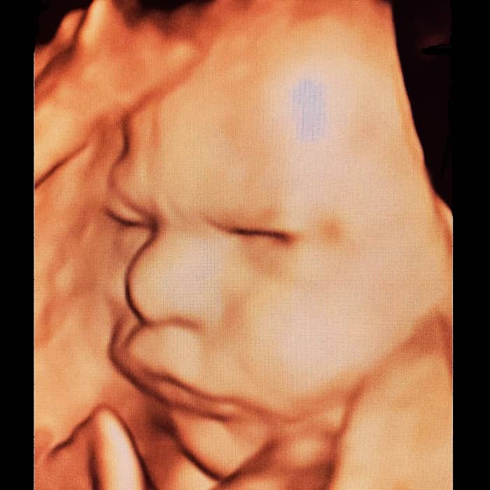 Ankara ayrıntılı ultrason randevusu, detaylı ultrason yapan hastaneler