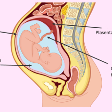 Amniyon Sıvısı Nedir? Gebelikte Suyun Azalması (Oligohidramnios)