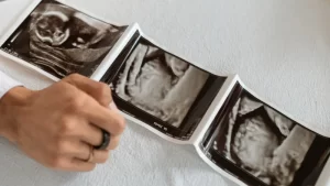 Perinatoloji Detaylı Ultrason Fiyatları